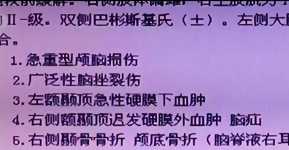 wincc怎么加报警声音-WinCC报警声音设置，轻松实现