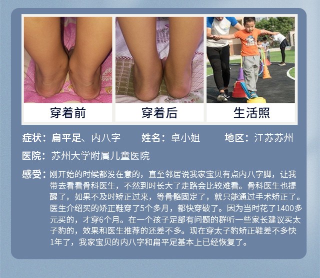 矫正鞋真的可以矫正腿型吗_矫正鞋每天穿多长时间_x型腿矫正鞋要一整天都穿吗