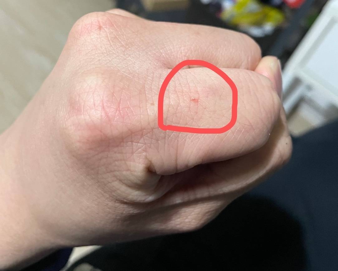 怎么抓流浪狗下的崽子-心疼流浪狗崽崽，如何给它们一个温暖的家？